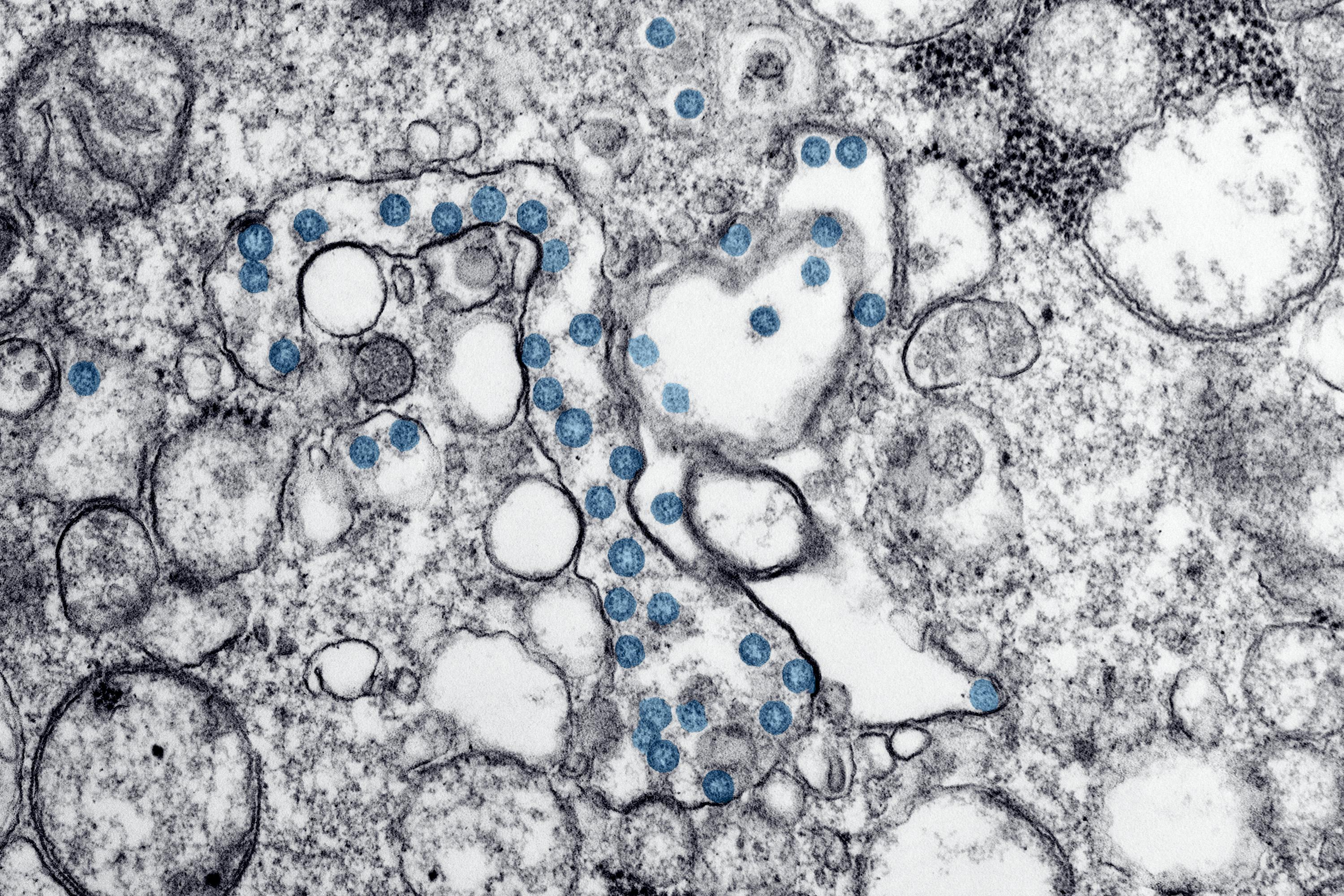 le microbiote intestinal