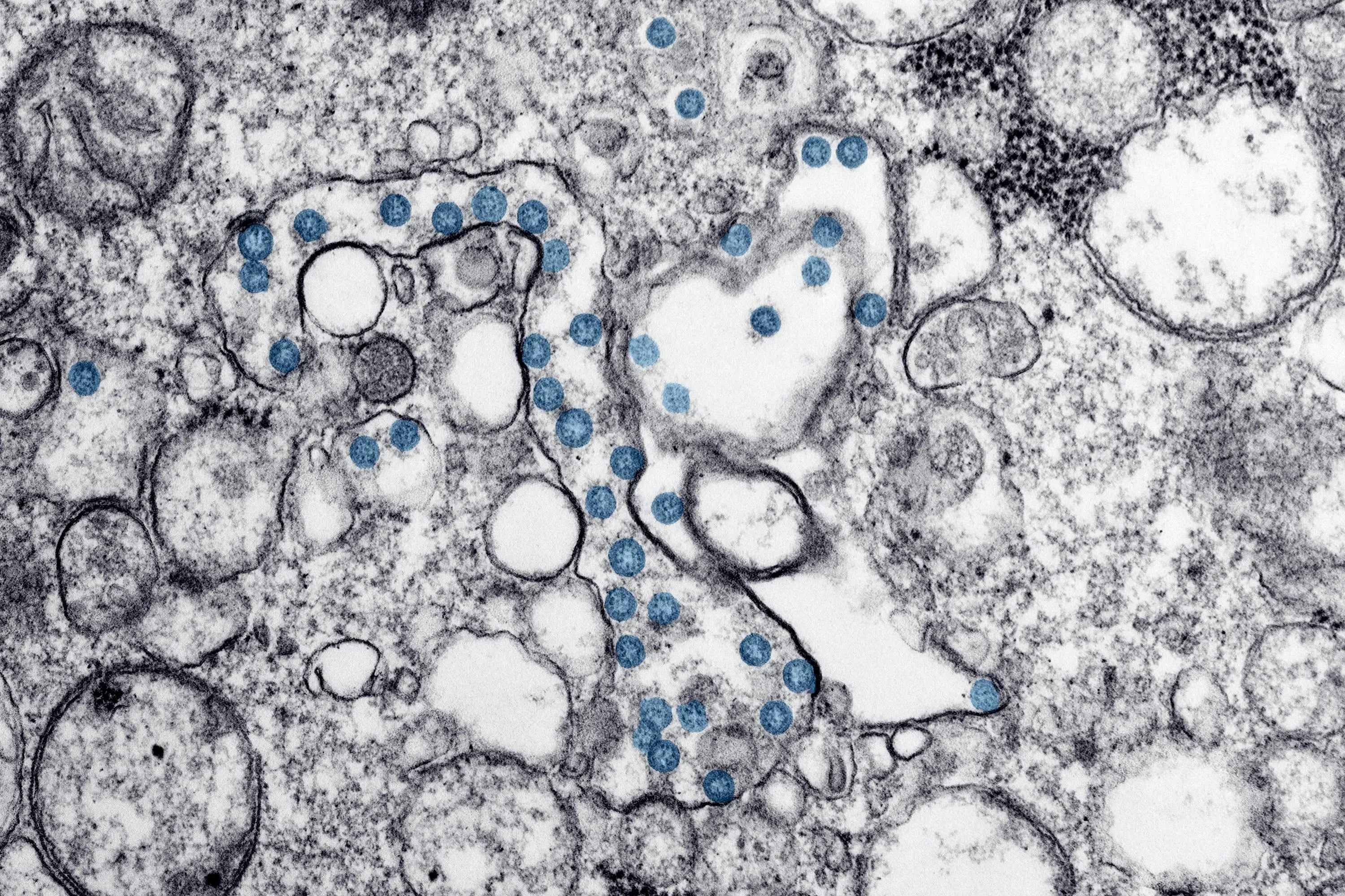 le microbiote intestinal
